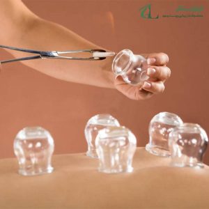 بادکش شیشه ای گرم سایز 1