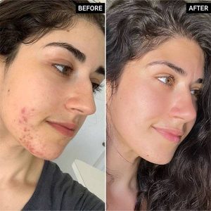 اسید 50 میل اف کازمتیک